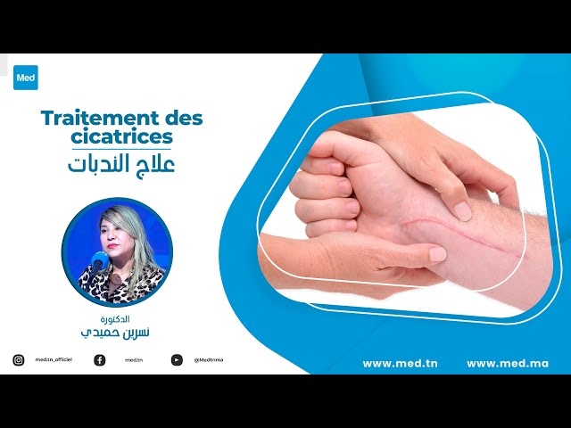 Video Traitement des cicatrices