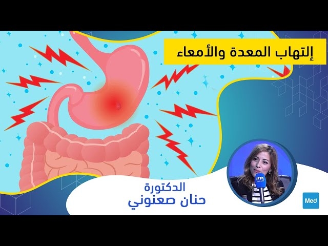 فيديو إلتهاب المعدة والأمعاء
