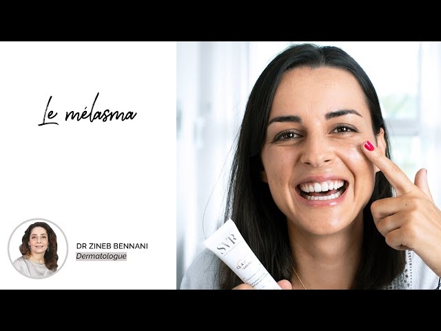 فيديو الكلف ما أسبابه وما علاجه