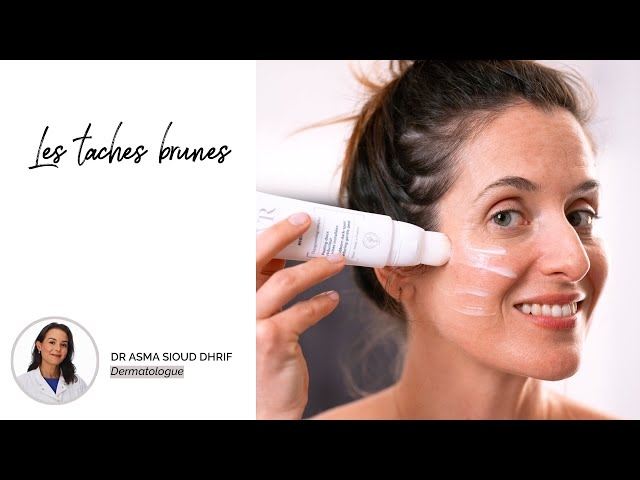 Video Les taches brunes 