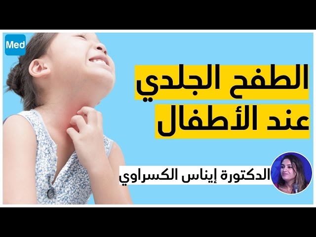 Video Eruptions cutanées chez l'enfant