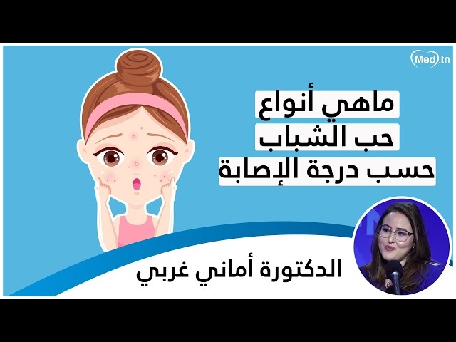 فيديو  حب الشباب  