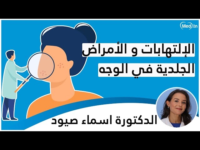Video الإلتهابات و الأمراض الجلدية في الوجه
