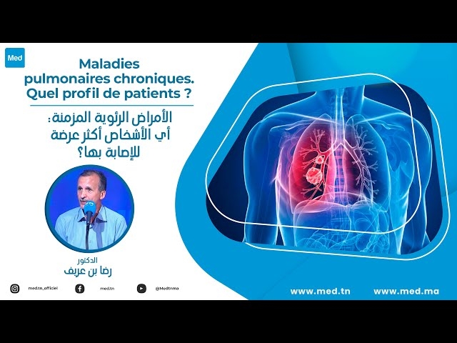 Video الأمراض الرئوية المزمنة: أي الأشخاص أكثر عرضة للإصابة بها؟