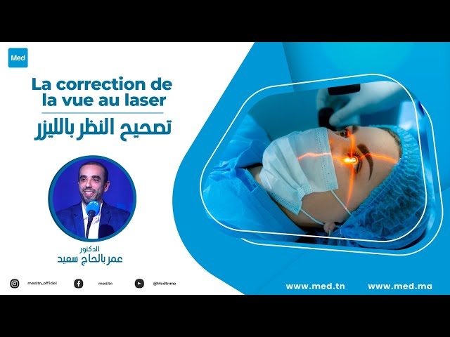 Video  La correction de la vue au laser 