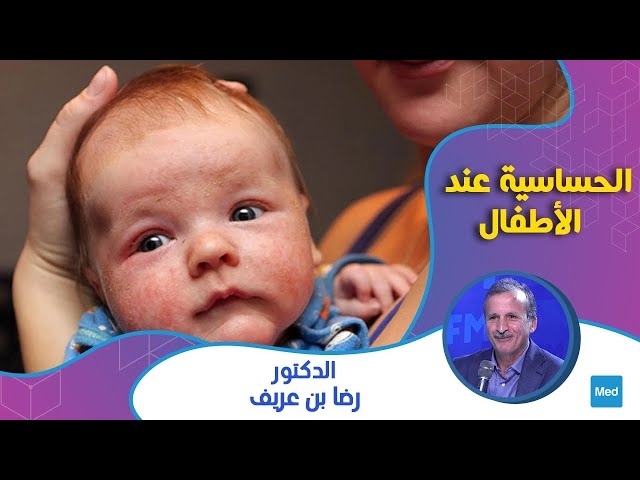 Video الحساسية عند الأطفال