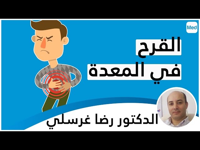 Video القرح في المعدة