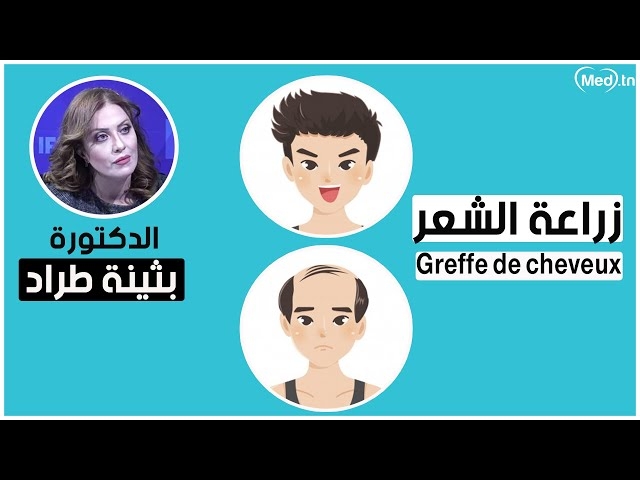 Video Greffe de cheveux 