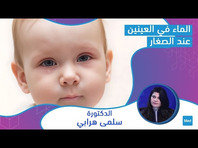 Video   الماء في العينين عند الصغار 