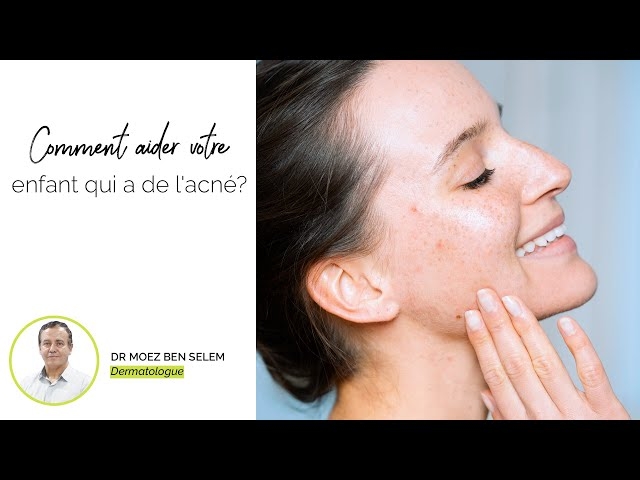 Video Dr Moez ben selem: Comment aider votre enfant qui a de l'acné?