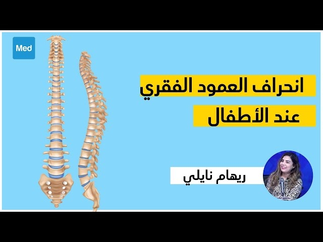 Video إنحراف العمود الفقري جانبيا عند الأطفال