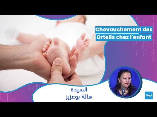 فيديو Chevauchement des orteils chez l'enfant