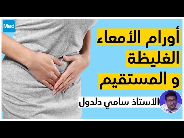 Video Le cancer colorectal 