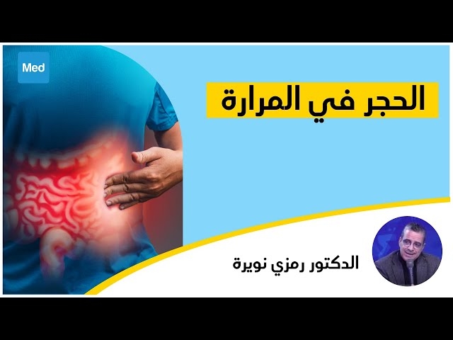 Video الحجر في المرارة