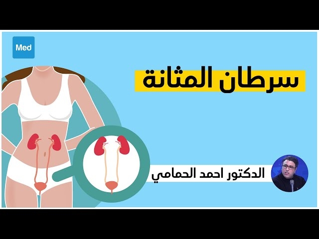 Video Le cancer de la vessie