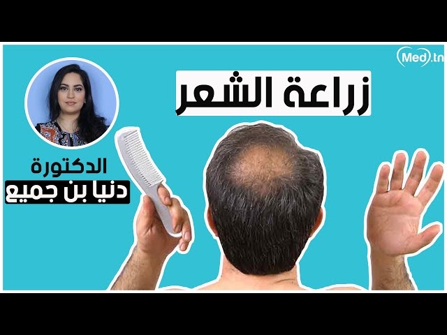 فيديو زرع الشعر
