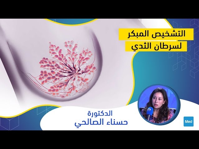 Video Dépistage précoce du cancer du sein