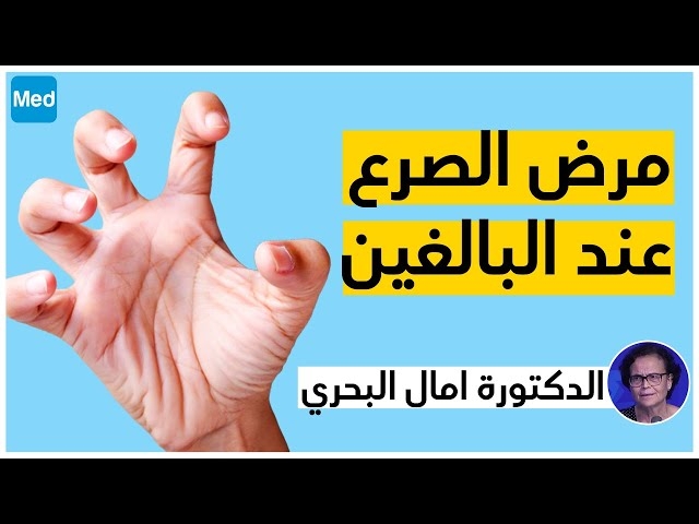 Video L'épilepsie chez l'adulte