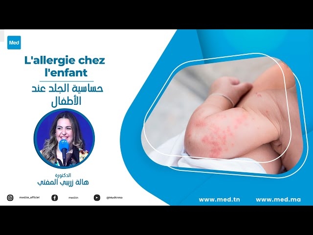 Video Allergie cutanée chez l’enfant