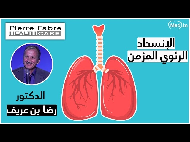 Video Servage tabagique 