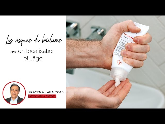 Video Les risques de brûlures selon localisation et l'age 