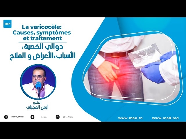 فيديو  دوالي الخصية: الأسباب،الاعراض و العلاج