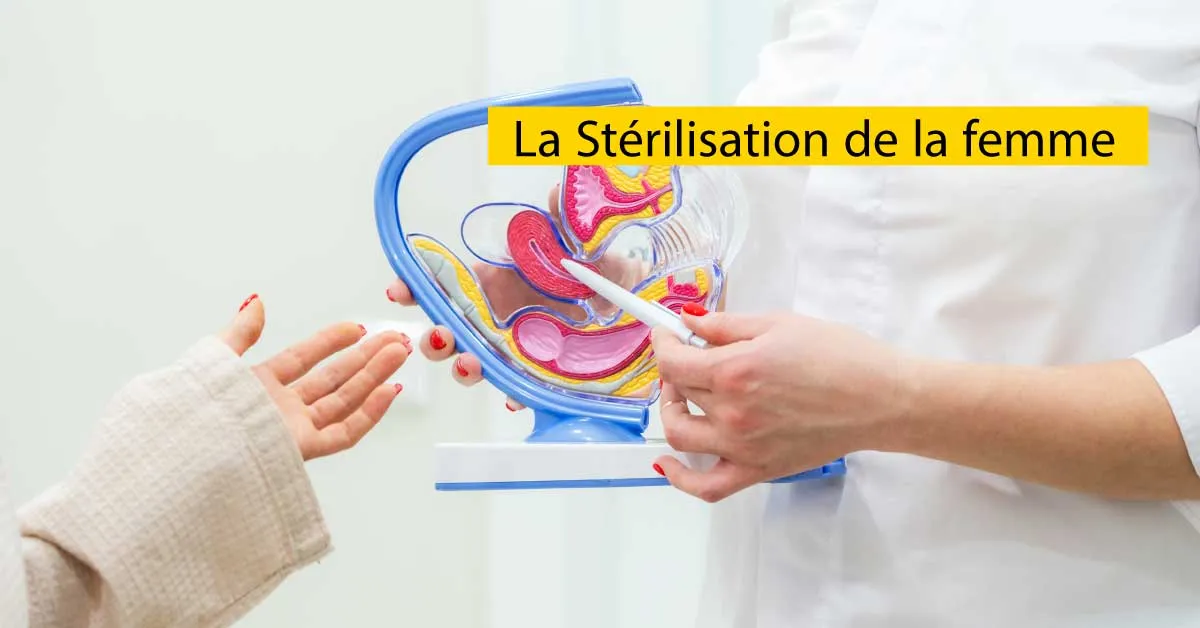 La Stérilisation de la femme 