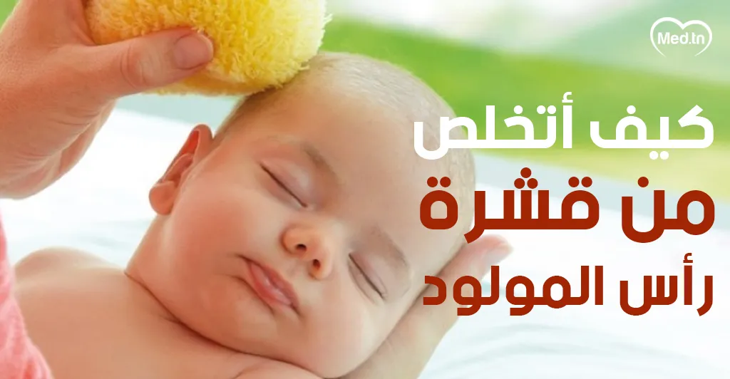كيف أتخلص من قشرة رأس المولود