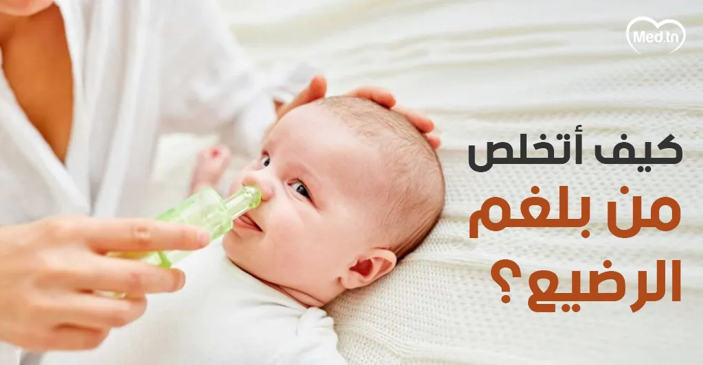 كيف أتخلص من بلغم الرضيع