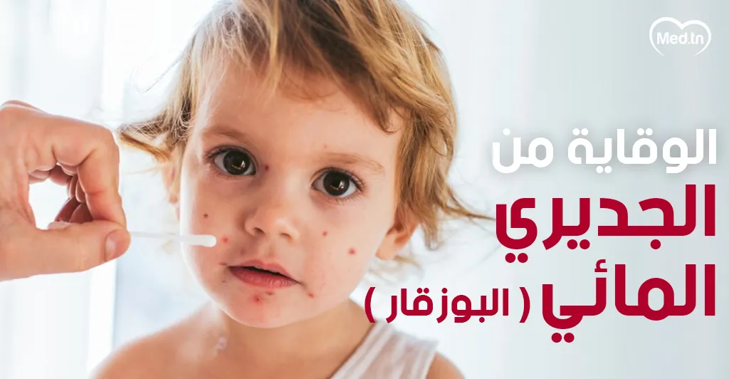  الوقاية من الجديري المائي ( البوزقار )