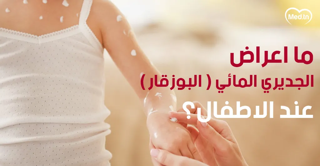  ما أعراض الجديري المائي عند الأطفال؟  ( البوزقار )