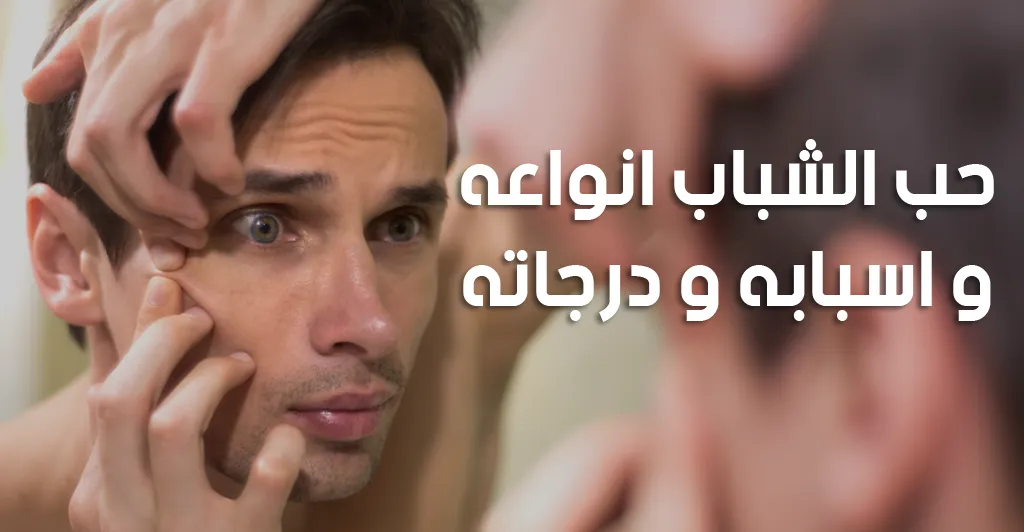 حب الشباب انواعه و اسبابه و درجاته