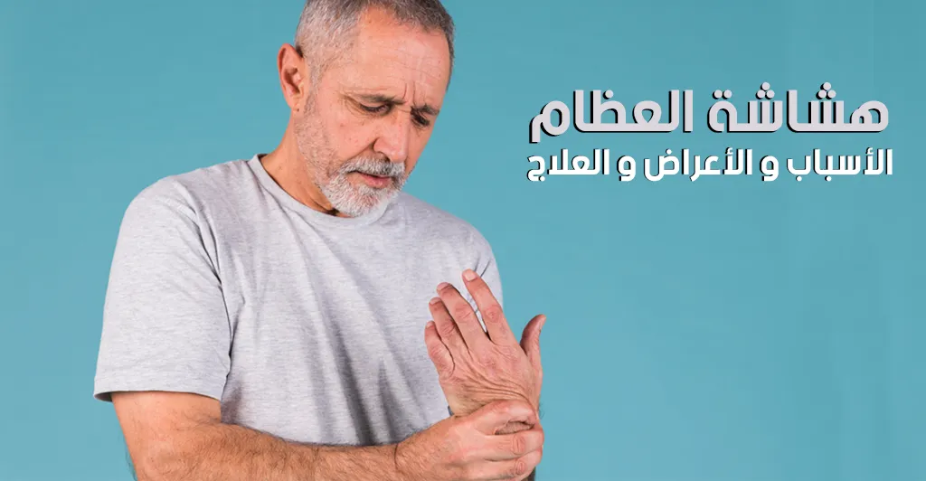 هشاشة العظام : الأسباب و الأعراض و العلاج