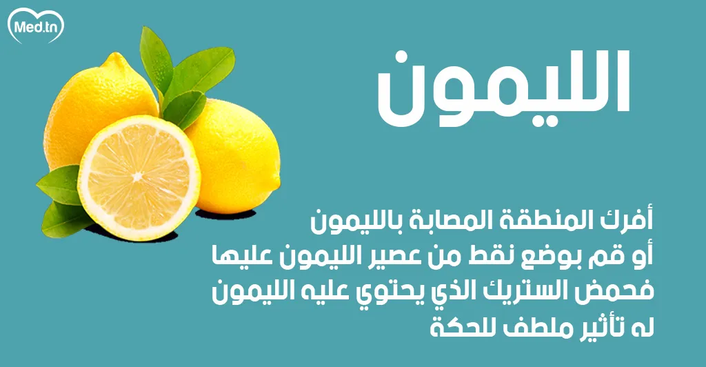 6 طرق طبيعية لعلاج قرصة الناموس