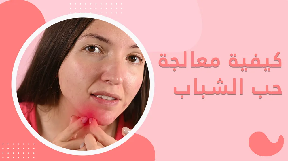 كيفية معالجة حب الشباب