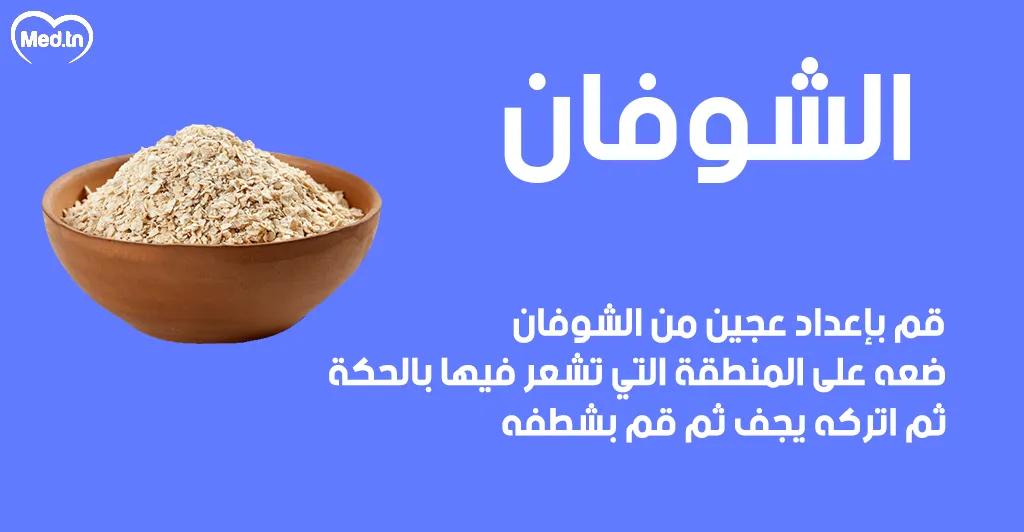 6 طرق طبيعية لعلاج قرصة الناموس