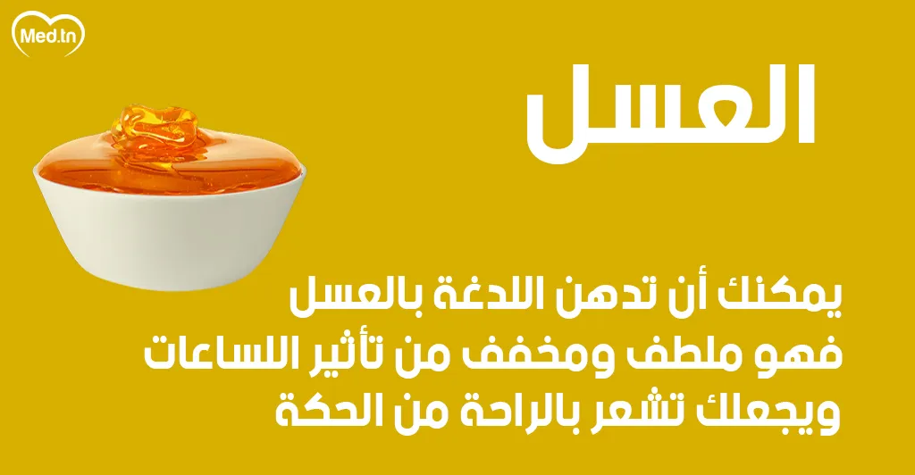 6 طرق طبيعية لعلاج قرصة الناموس