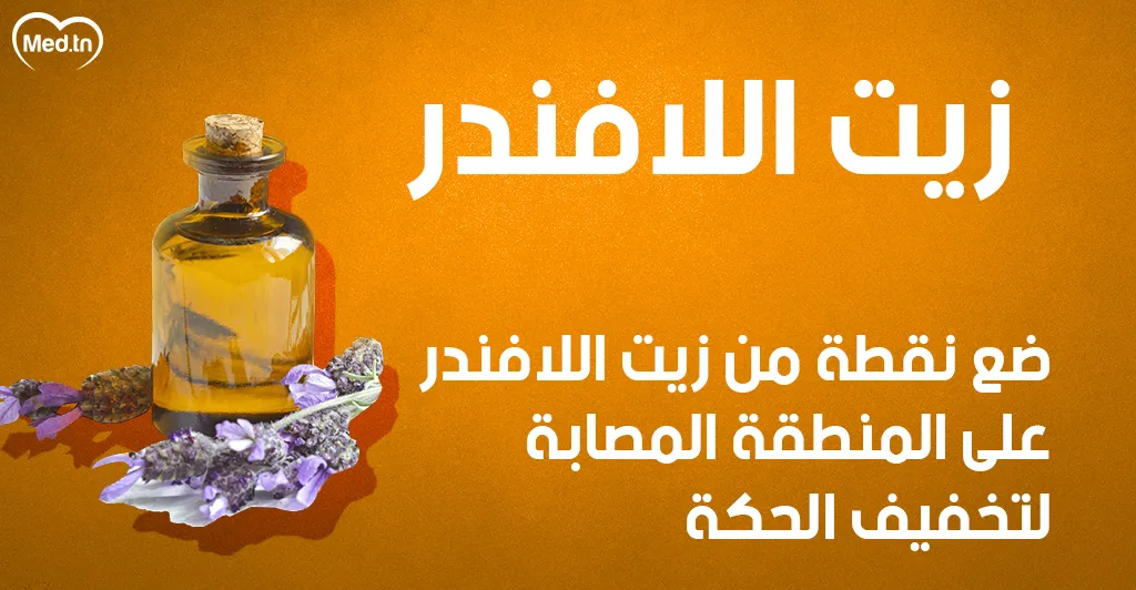 6 طرق طبيعية لعلاج قرصة الناموس