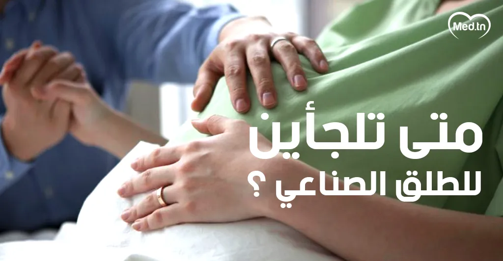 متى تلجأين للطلق الصناعي