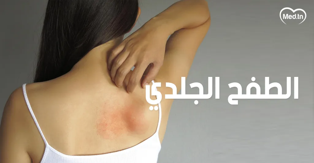 4 أعراض تصيب الحامل في الصيف   