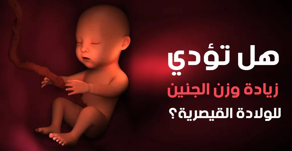هل تؤدي زيادة وزن الجنين للولادة القيصرية؟