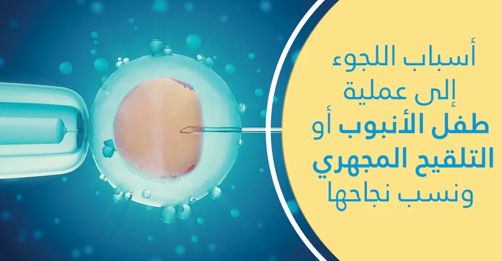 أسباب اللّجوء إلى عمليّة طفل الأنبوب أو التّلقيح المجهري ونسب نجاحها