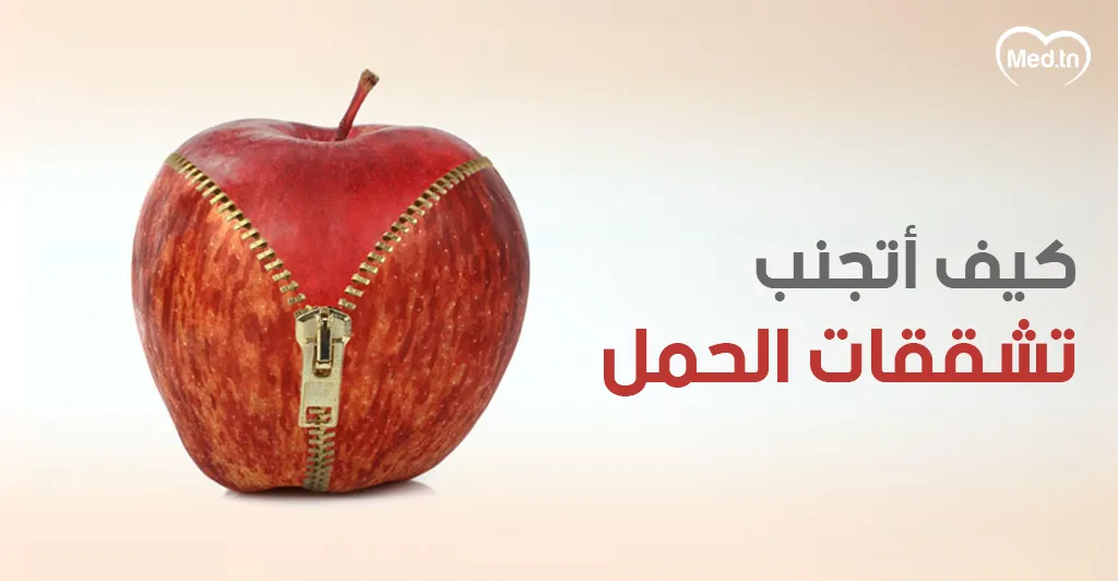 كيف أتجنب تشققات الحمل