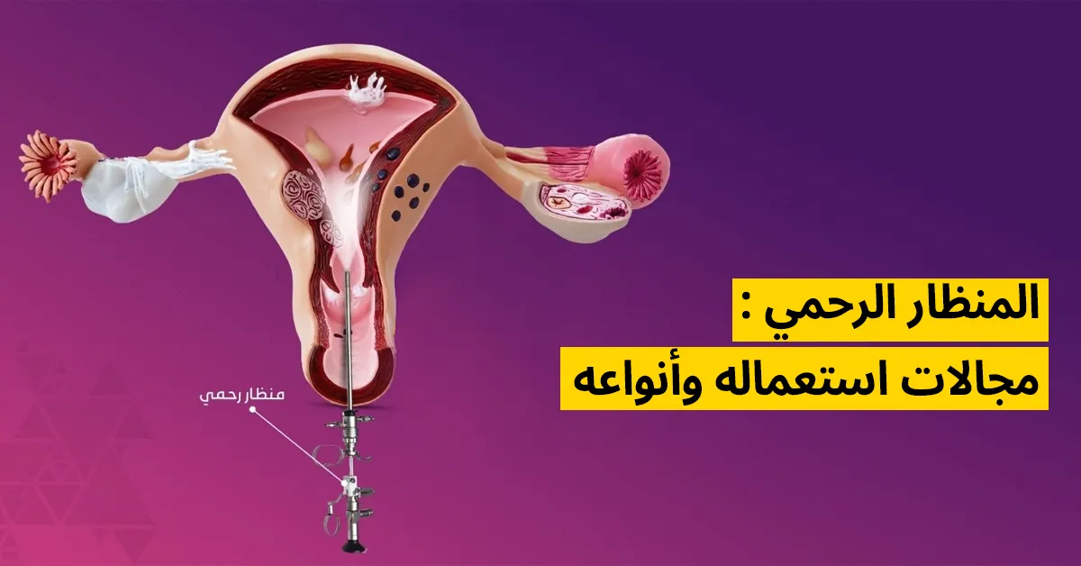 المنظار الرحمي : مجالات استعماله وأنواعه