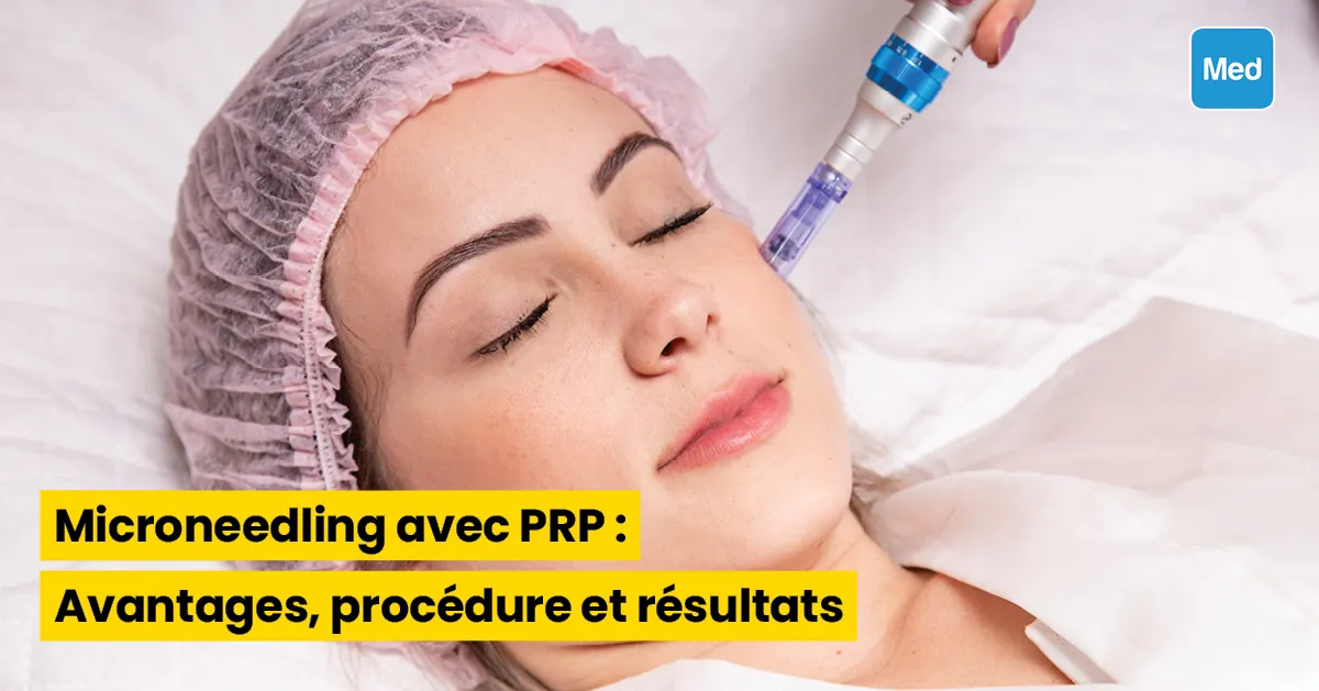 Microneedling avec PRP : Avantages, procédure et résultats