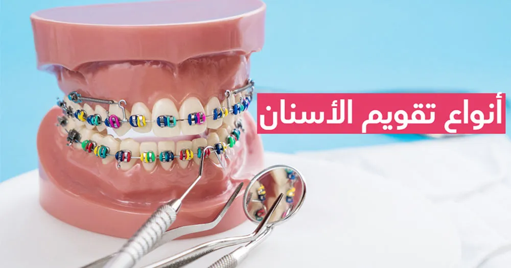 تقويم الأسنان