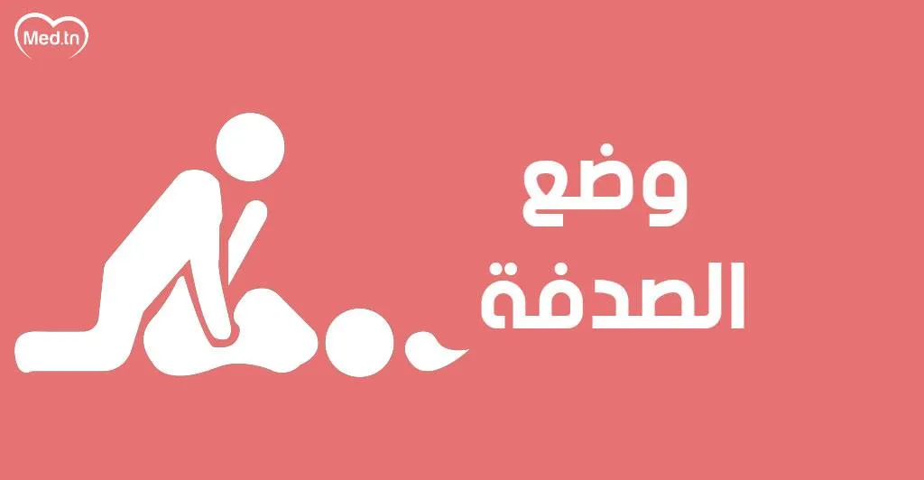 وضع الصدفة: