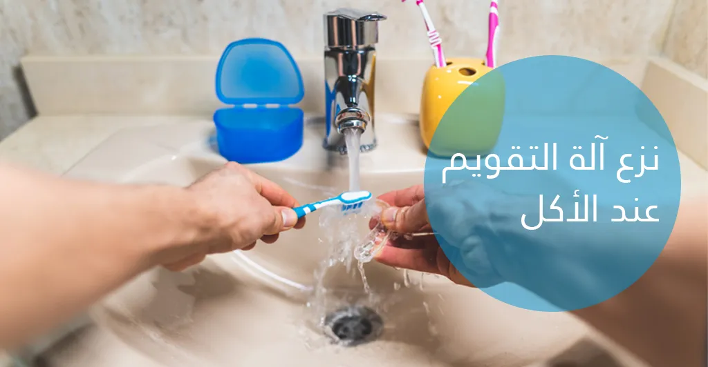 طرق تقويم الأسنان و كيفية المحافظة على النتائج