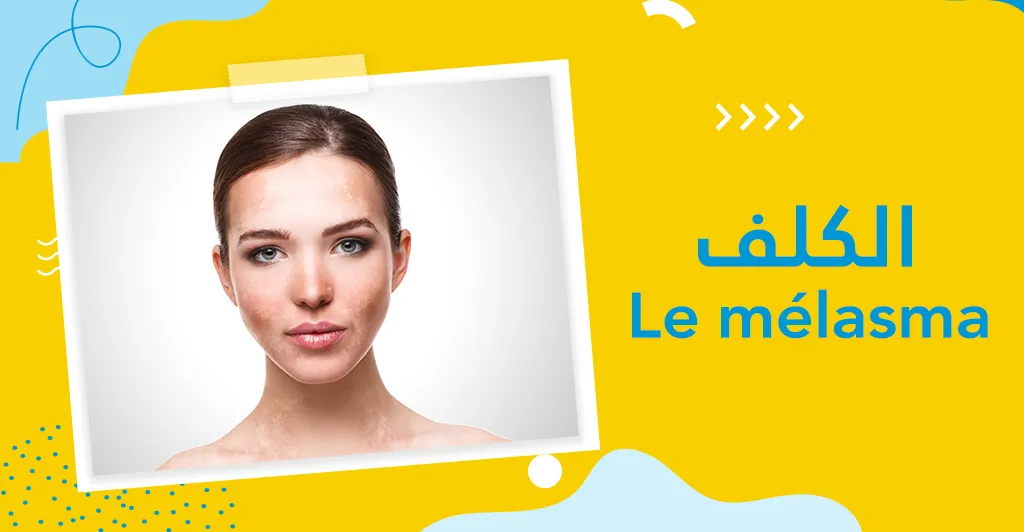 التصبغات الجلدية :أصنافها و أسبابها و طرق العلاج