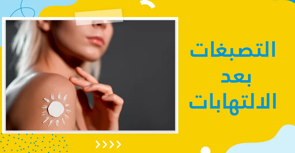 التصبغات الجلدية :أصنافها و أسبابها و طرق العلاج